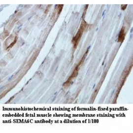 SEMA6C Antibody