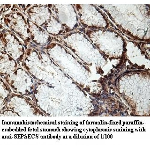 SEPSECS Antibody