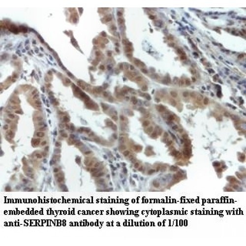 SERPINB8 Antibody