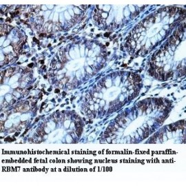 RBM7 Antibody