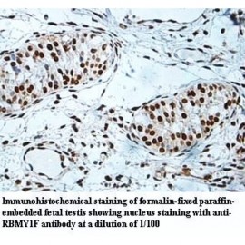 RBMY1F Antibody