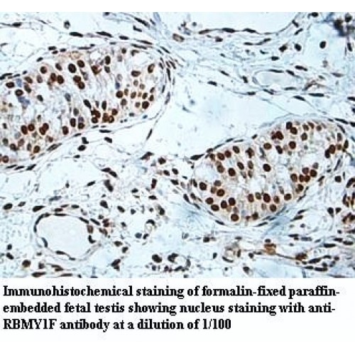 RBMY1F Antibody