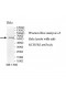 RCBTB2 Antibody