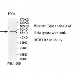 RCBTB2 Antibody