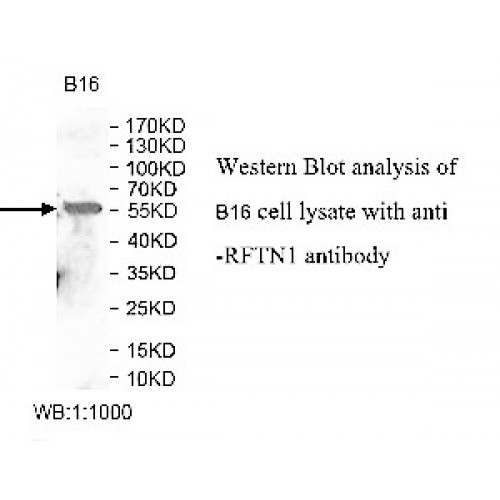 RFTN1 Antibody