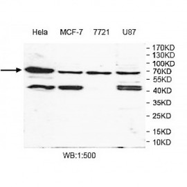 TKT Antibody