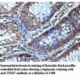 TIGD7 Antibody