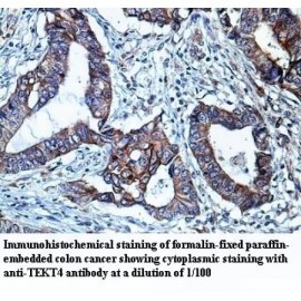 TEKT4 Antibody