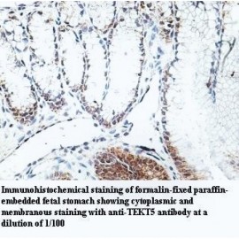 TEKT5 Antibody