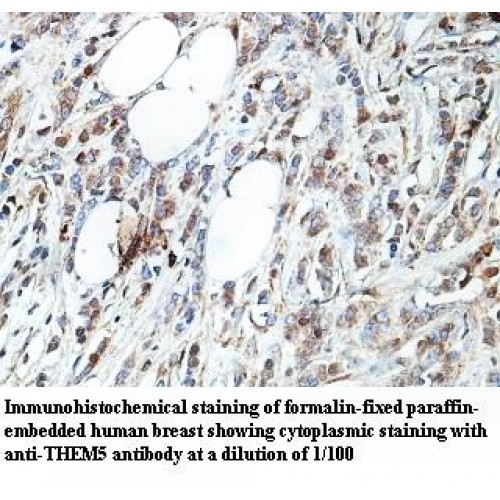 THEM5 Antibody