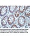THOC3 Antibody