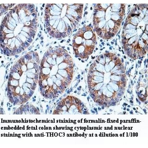 THOC3 Antibody