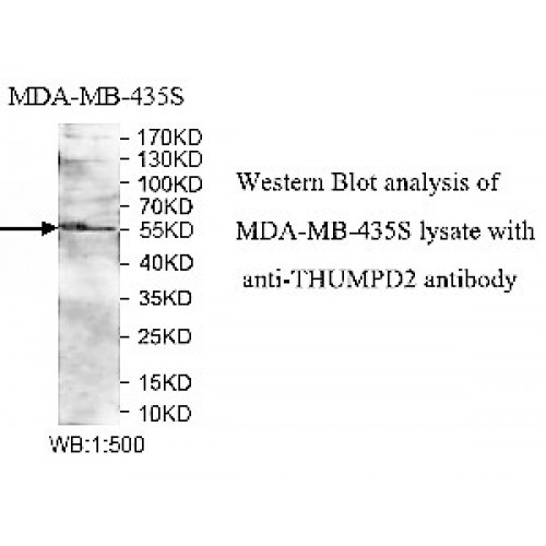 THUMPD2 Antibody