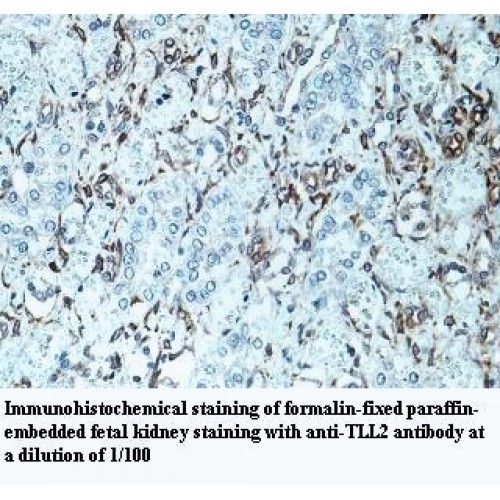 TLL2 Antibody