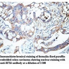 RFX6 Antibody