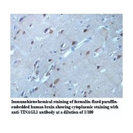TINAGL1 Antibody