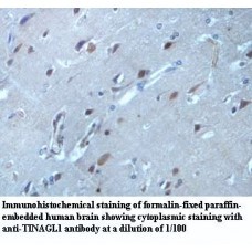 TINAGL1 Antibody